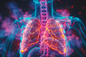 Adaptive RT for Non-Small Cell Lung Cancer (NSCLC)